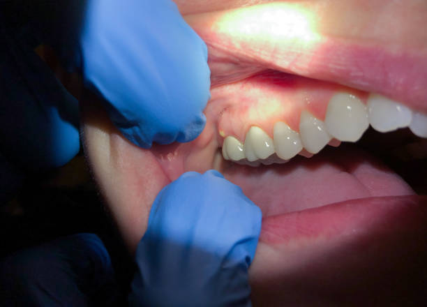 Best Emergency Cosmetic Dentistry (e.g., broken veneers) in Beecher, IL
